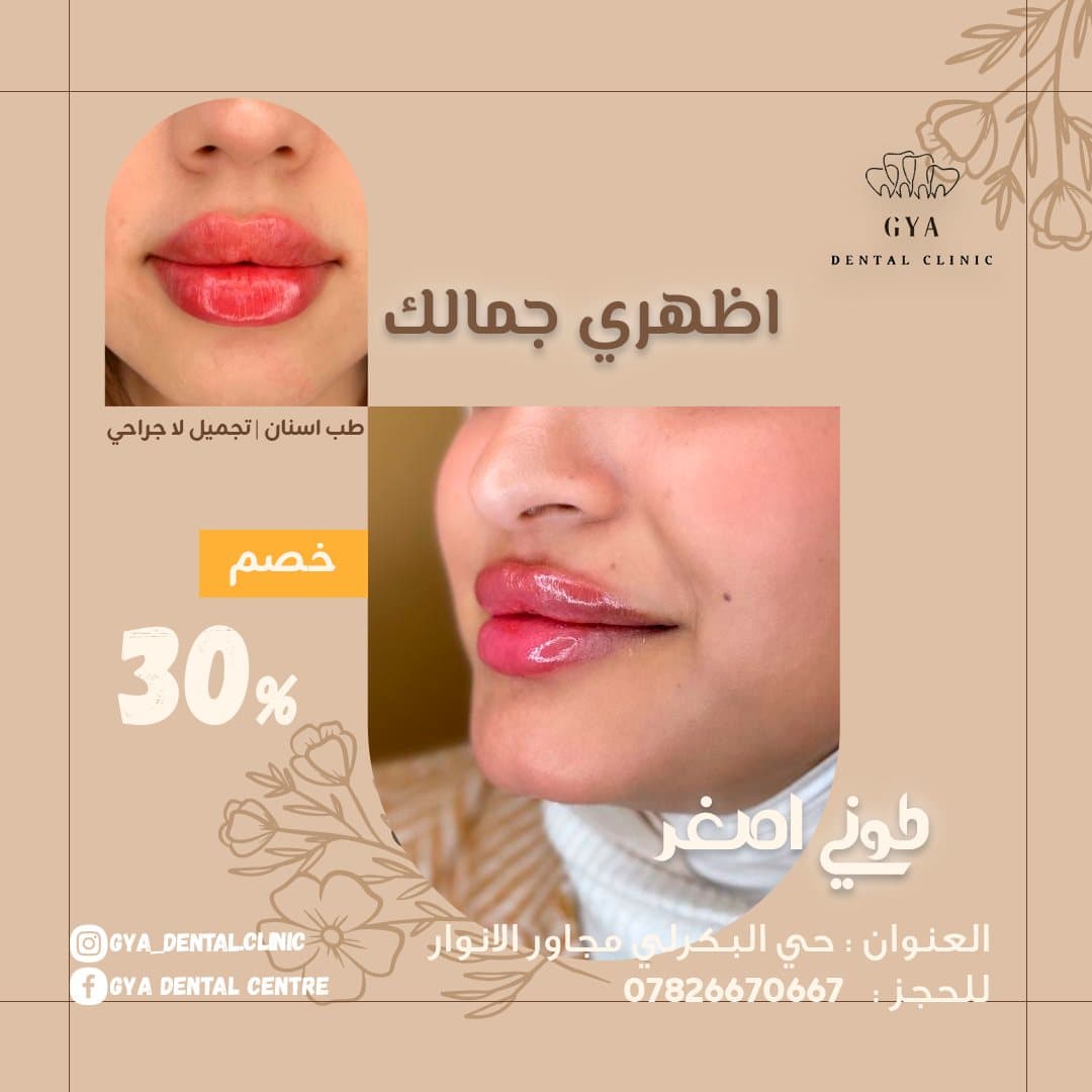 إعلان عرض، GYA Dental Clinic