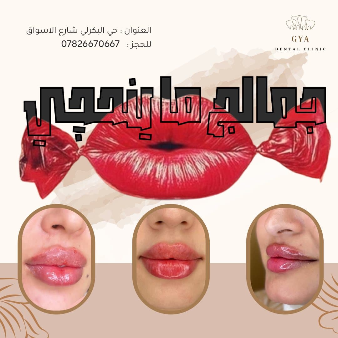 بوست تجميل، GYA Dental Clinic