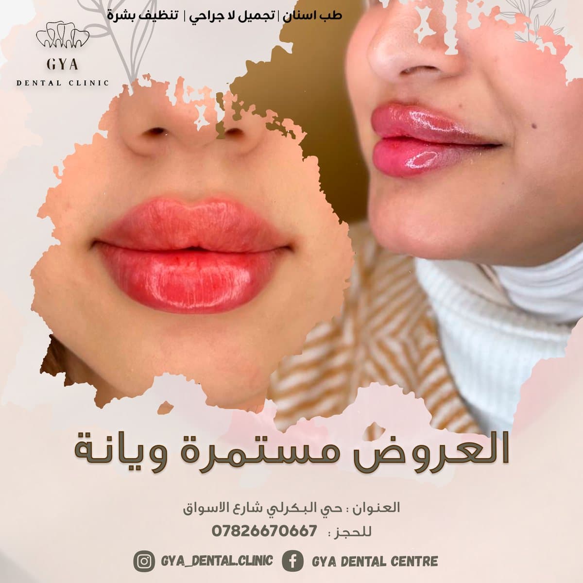 إعلان عروض، GYA Dental Clinic
